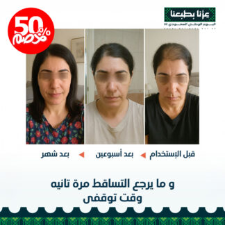 علاج تساقط الشعر العرضي و الحماية من التساقط الموسمي