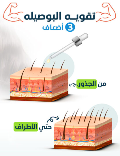 علاج تساقط الشعر العرضي و الحمايه من التساقط الموسمي - Image 4