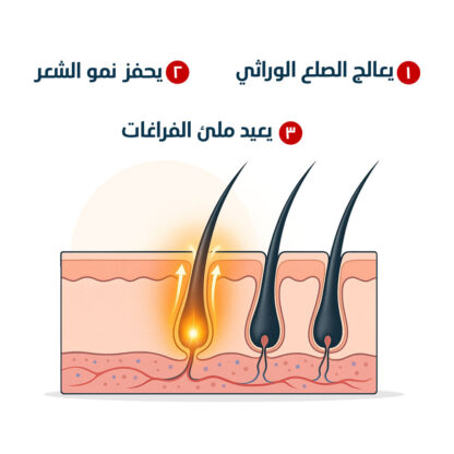 عرض Faster Oilex Oil – تركيز 10 كيلو ثوم طبي في عبوة واحدة لوقف التساقط وإنبات الفراغات بسرعة - Image 6