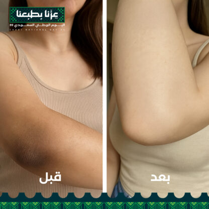 مجموعة التحكم بدرجة لون الجسم و مانع الاسمرار المستقبلي بديل حقن التبييض - Image 6