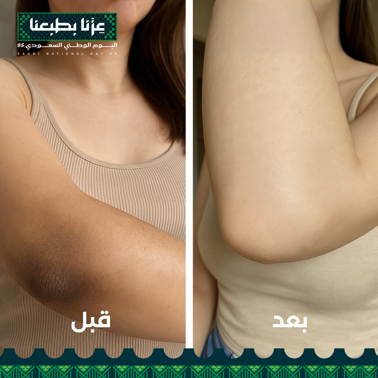 مجموعة التحكم بدرجة لون الجسم و مانع الاسمرار المستقبلي بديل حقن التبييض - Image 6