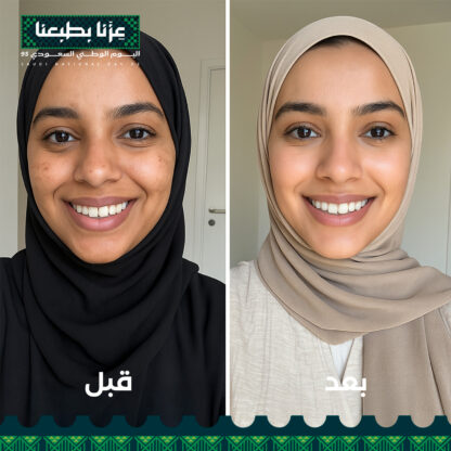 مجموعه مانع التصبغات و منورة البشرة - تنوير من الداخل و الخارج للبشرة - Image 6