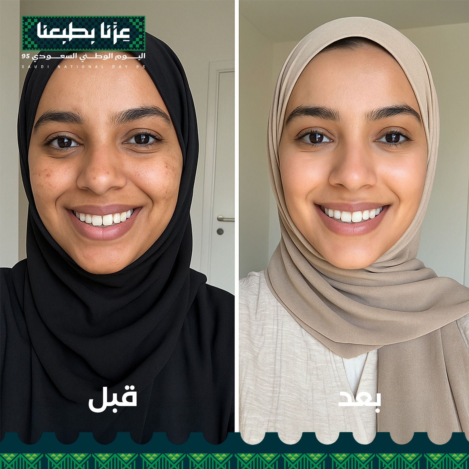 مجموعه مانع التصبغات و منورة البشرة - تنوير من الداخل و الخارج للبشرة - Image 6