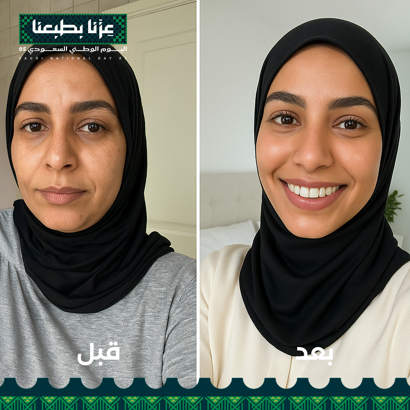 بديل الفيلر الفاخر-  مجموعة العناية الكاملة ضد التجاعيد - Image 6